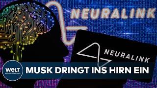 ERSTER SCHRITT ZUM CYBORG? Musk jubelt - Neuralink darf Hirn-Computer-Schnittstelle am Mensch testen