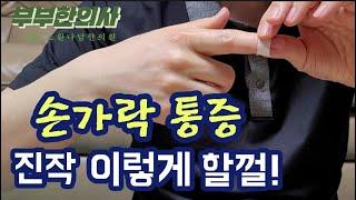 100. 손가락이 붓고 통증이 있다면 꼭 시청하세요. (손가락관절염) | 한의학박사, 침구과전문의, 산청김, 김경태원장 ㅣ ft 부부한의사