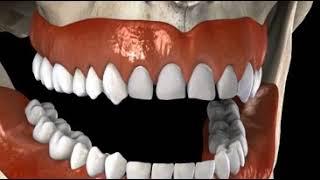 Veneers Worn, Porcelain lab