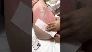 Brazilian Waxing No Hurt No Pain