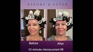 What Can Microcurrent do for you?
