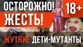 ШОК! САМЫЕ ЖУТКИЕ ДЕТИ-МУТАНТЫ! 18+ НЕ ДЛЯ СЛАБОНЕРВНЫХ!