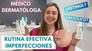 DERMATÓLOGA EXPLICA RUTINA EFECTIVA PARA IMPERFECCIONES PASO A PASO