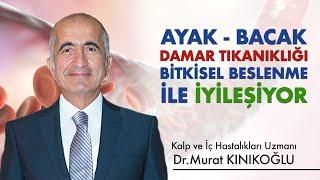 Ayak - Bacak Damar Tıkanıklığını Bitkisel Beslenmeyle İyileştirebilirsiniz