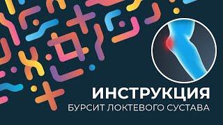 Kinexib - тейпирование бурсита локтевого сустава