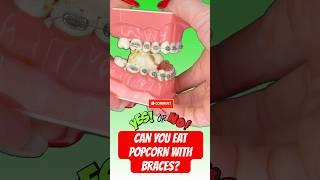 CAN YOU EAT POPCORN WITH BRACES? ASMR  #braces #poocorn #asmr