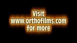 Orthofilms Trailer