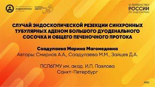 Случай эндоскопической резекции синхронных тубулярных аденом большого дуоденального сосочка