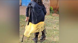 A disabled woman with polio walks on crutches #disability #polio