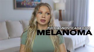 Fui diagnosticada com MELANOMA