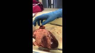 heart dissection