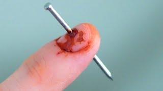 NAIL IN FINGER!