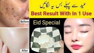 Multani Mitti Face Pack For Glowing Skin| 1 Day Skin Whitening Challenge | Skin Whitening Remedies