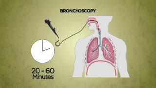 Bronchoscopy