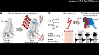 Electrochemical neuromodulation therapies to the spinal cord