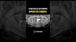 [부산전체임플란트] 디지털 진단으로 임시치아까지, 감쪽같은 앞니 임플란트 #shorts