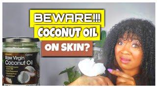 WHY COCONUT OIL SHOULDN'T BE USED ON FACE