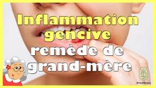 Inflammation gencive remède grand-mère