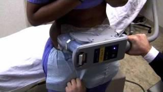 CoolSculpting NYC alternative to liposuction