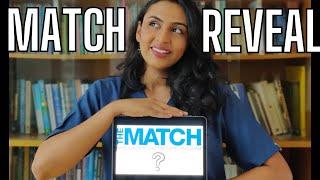 My US Residency Match Story &  Program Reveal | IM Match 2023