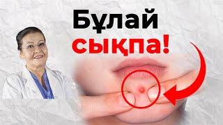 БЕЗЕУ ШЫҚҚАНДА не істеу керек?! | Безеуді қалай кетіруге болады үй жағдайында | безеу сығу