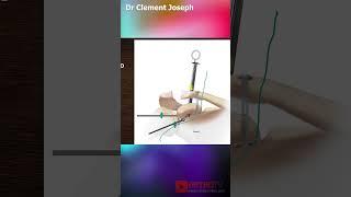 AC Joint Reconstruction by Dr Clement Joseph