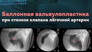 Баллонная вальвулопластика при стенозе клапана легочной артерии. Balloon Valvuloplasty in dog