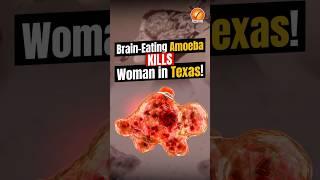 Brain-Eating Amoeba Kills Woman in Texas!