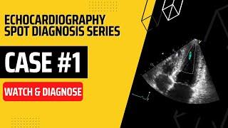 Case 1: Echocardiography Spot Diagnosis Case Series | Watch & Diagnose | Learn Echo Findings | TOACS