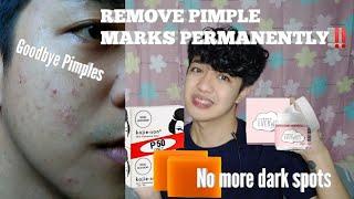 BEST PRODUCT TO REMOVE DARK SPOTS| Everwhite and Kojie San Review |Rex Novida