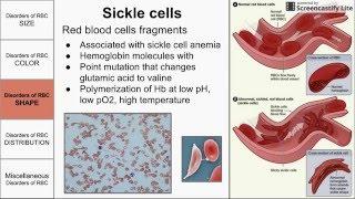 Red Blood Cell Morphological Abnormalities