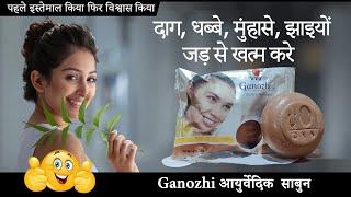 दाग, धब्बे,  झाइयों  जड़ से खत्म करे  |  DXN Ganozhi Soap Review