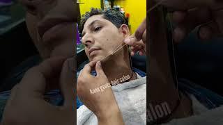 wart removal treatment  मस्सा हटाने का उपचार#shorts #massa #skintag #skinwarts #viral #warttreatment