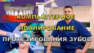 Протезирование зубов в Киеве – видео о технологиях в Люми-Дент