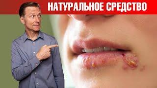 Герпес на губах? Эти 3 средства мгновенно избавят от герпеса