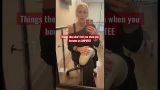 Things they don’t tell you when you become an amputee #amputee #limbloss #phantompain #nervepain