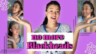 How to get rid of blackheads | RiTiSmiTa KaLiTa