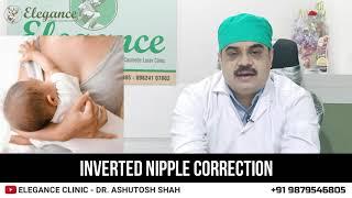 Inverted Nipple Correction at Elegance Clinic Surat, Gujarat, Mumbai, Maharashtra, Udaipur Rajasthan