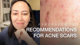 Recommendations For Acne Scars | VMV Hypoallergenics Snippets