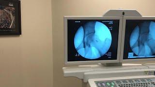 Intra-Articular Injection of the Hip Under Fluoroscopic Guidance