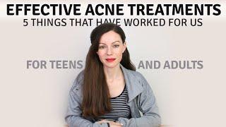 Acne Treatments at Home: 5 Things That Have Worked for Us.