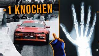 Zerstört in Sekunden | Drift Crash | Finger gebrochen ️