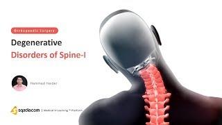 Degenerative Disorders of Spine -I | Orthopedic Surgery Lectures | V-Learning | sqadia.com