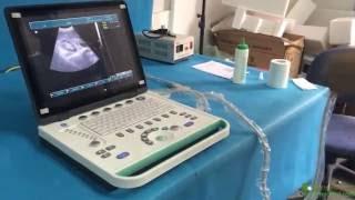 cheap 3d laptop ultrasound machine MSLPU34 video