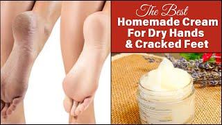 Best Home Remedy to Remove Cracked Heels Fast | Vaseline Magic on Skin | Cracked Heels Home Remedy