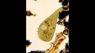 Nature’s Micro Engineers  The Fascinating World of Stentor