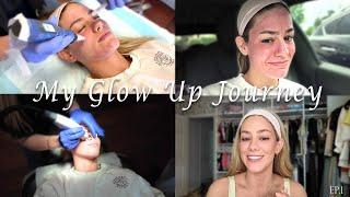 GLOW UP SERIES | Road To The Wedding: I get Microneedling done! | Ep. 1