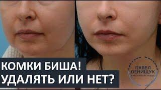 Комки Биша: УДАЛЯТЬ или НЕТ? | Вопросы и ответы