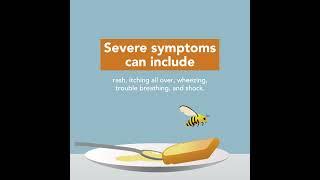 Bee Stings: Symptoms & Treatment | Merck Manual Consumer Version