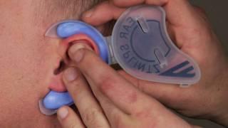 Cauliflower Ear Prevention & Treatment [2020 EarSplintz]